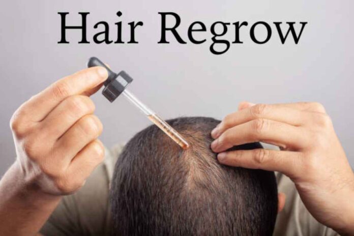 How to Regrow Hair_ Your Guide to Proven Solutions
